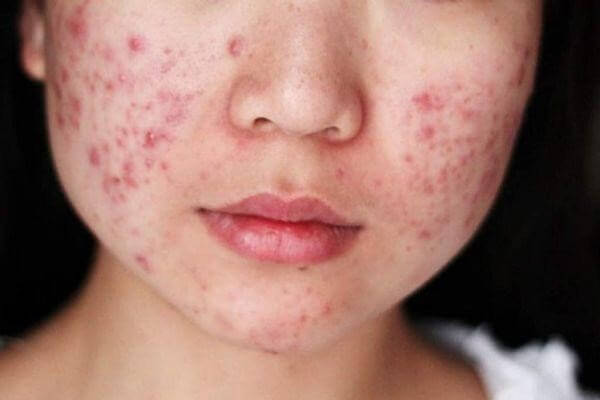 mặt nạ dưỡng da 4