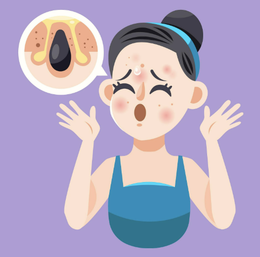 cách điều trị mụn nhọt đúng cách